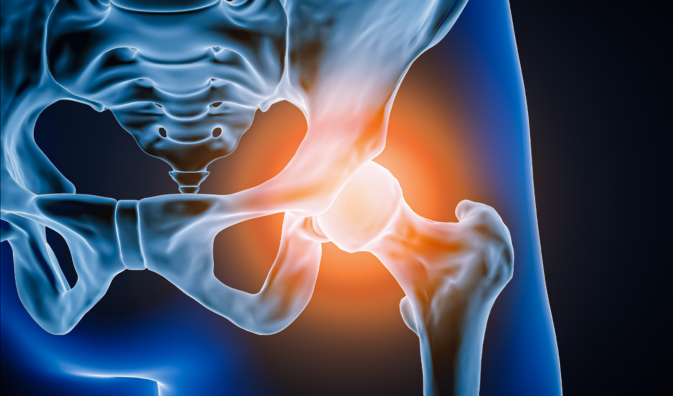 Illustration of hip joint anatomy showing inflammation and pain in the pelvic bone and femur, representing hip surgery, hip replacement, and outpatient surgical care options