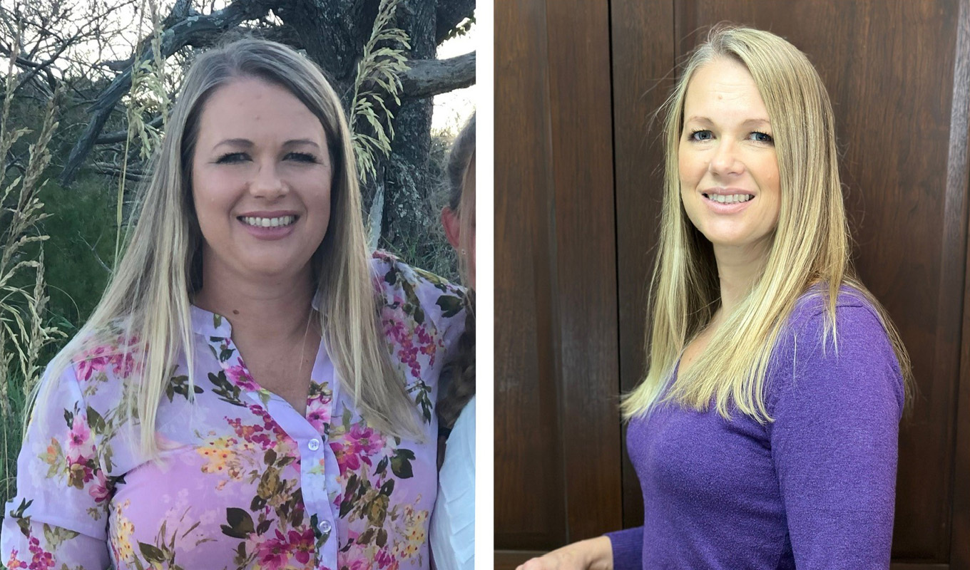 Before and after photos of woman who lost weight.